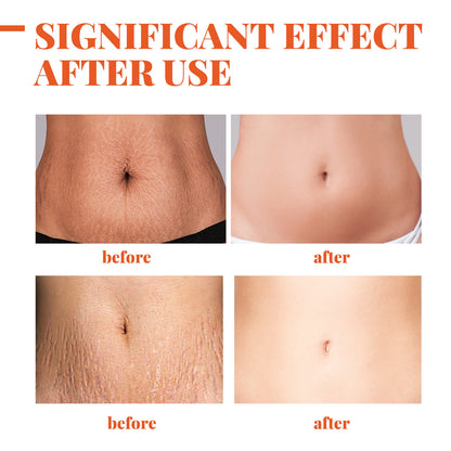 Scar Repairing Essential Oil Pregnant Women Lifting Relaxation Line Firming