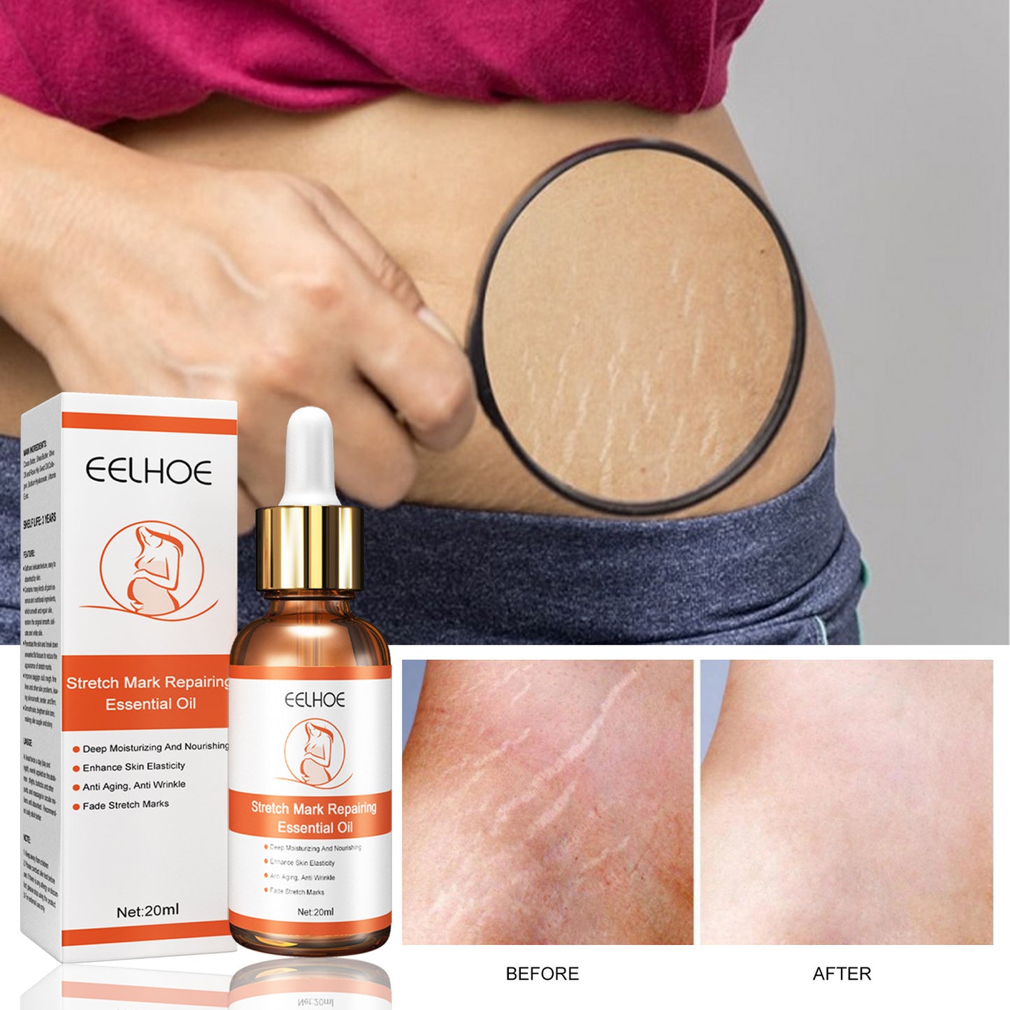 Scar Repairing Essential Oil Pregnant Women Lifting Relaxation Line Firming
